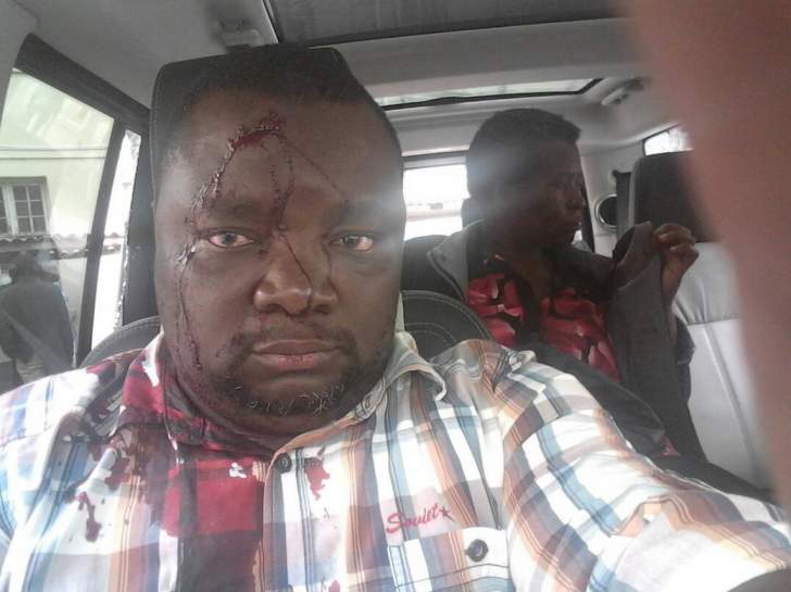 Bloody clashes rock MDC-T
